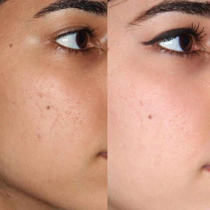 1L FULL BODY LIGHTENING OIL(2 shades lighter)