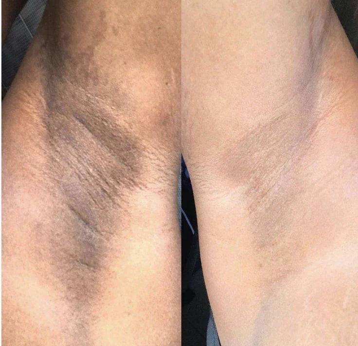 Full Body brightening Package (2 shades lighter) 7 pack set